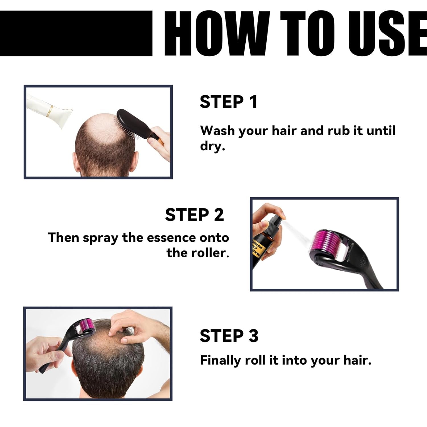 Advanced Hair Growth Treatment Kit 30ml 2ST Hair Growth Spray Hair Growth Roller och Essence Set Hair Growth Serum Anti Håravfall Advanced Hair Growth Serum Hårvård Naty Shop