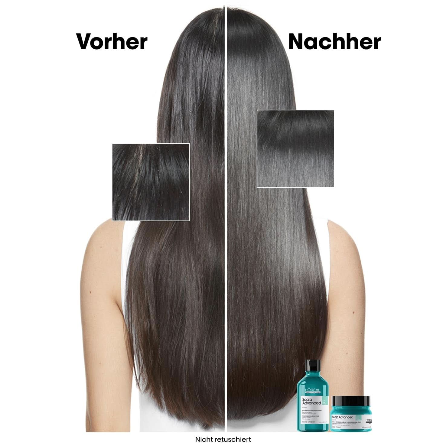 L'Oréal Professionnel rengöringsschampo för fet hårbotten, 300 ml Naty Shop dusch och bad