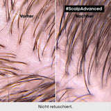 L'Oréal Professionnel rengöringsschampo för fet hårbotten, 300 ml Naty Shop dusch och bad