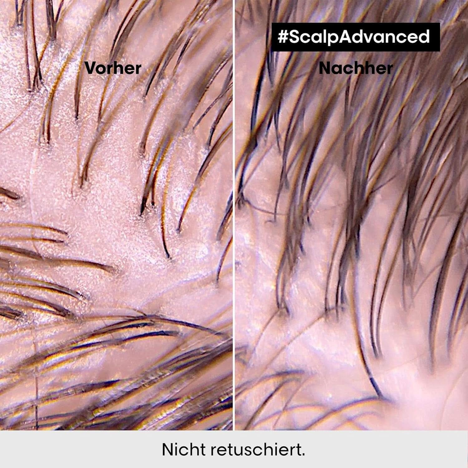 L'Oréal Professionnel rengöringsschampo för fet hårbotten, 300 ml Naty Shop dusch och bad