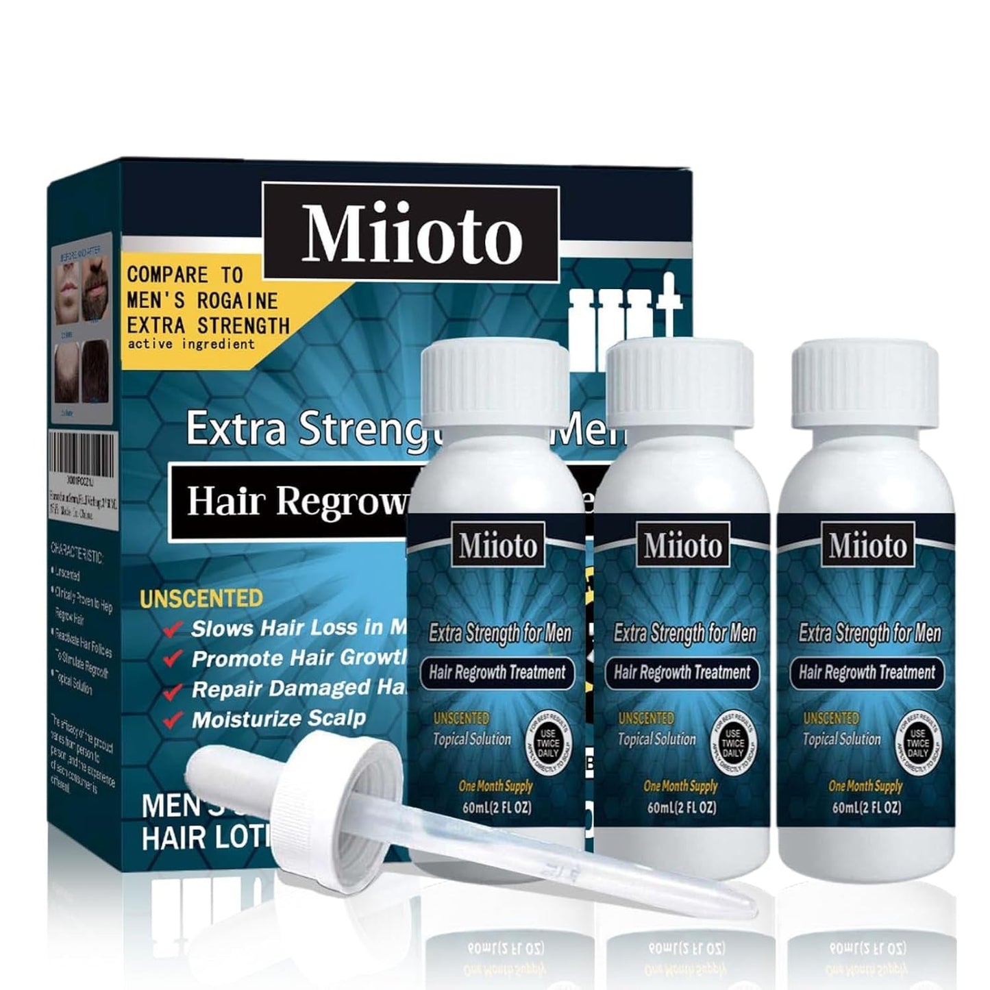 Miioto hårväxtserum, hårtillväxtprodukt för män, hårtillväxtserum, hårbottenvård Främja tjockare hår ger näring till hårbotten och förhindrar håravfall, 3*60 ml hårvård Naty Shop Standardtitel