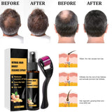 Advanced Hair Growth Treatment Kit 30ml 2ST Hair Growth Spray Hair Growth Roller och Essence Set Hair Growth Serum Anti Håravfall Advanced Hair Growth Serum Hårvård Naty Shop