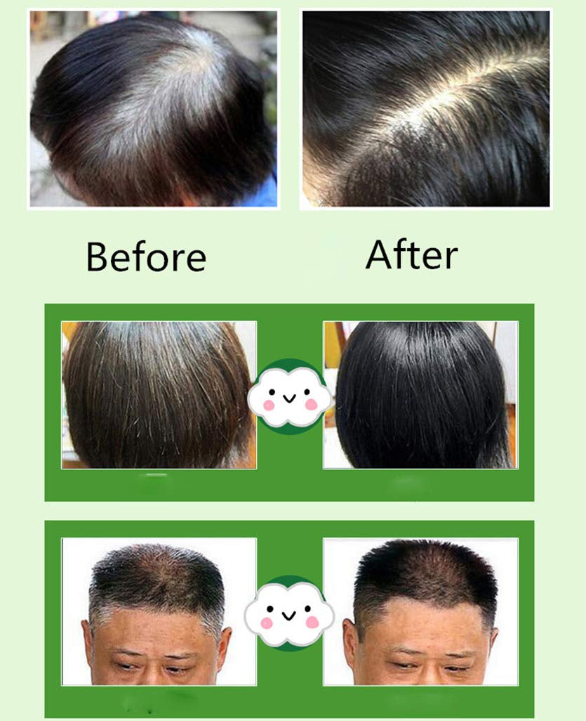 Naturliga ingredienser Instant Black Hair Dye Shampoo, Semi Permanent Black Hair Dye, Lätt att använda, Långvarig, Naturliga ingredienser (10 stycken, svart) Naty Shop Hårfärgning