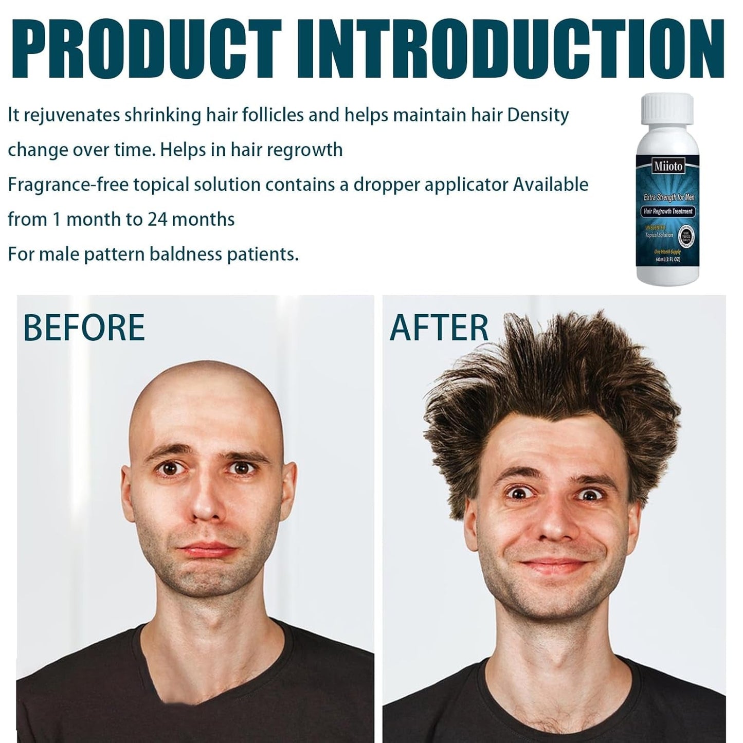 Miioto Hair Growth Serum Herr Hårväxt Produkt Hårväxt Hår Serum Hårbottenvård Främja tjockare hår Nära hårbotten Förhindra håravfall 3*60ML Hårvård Naty Shop