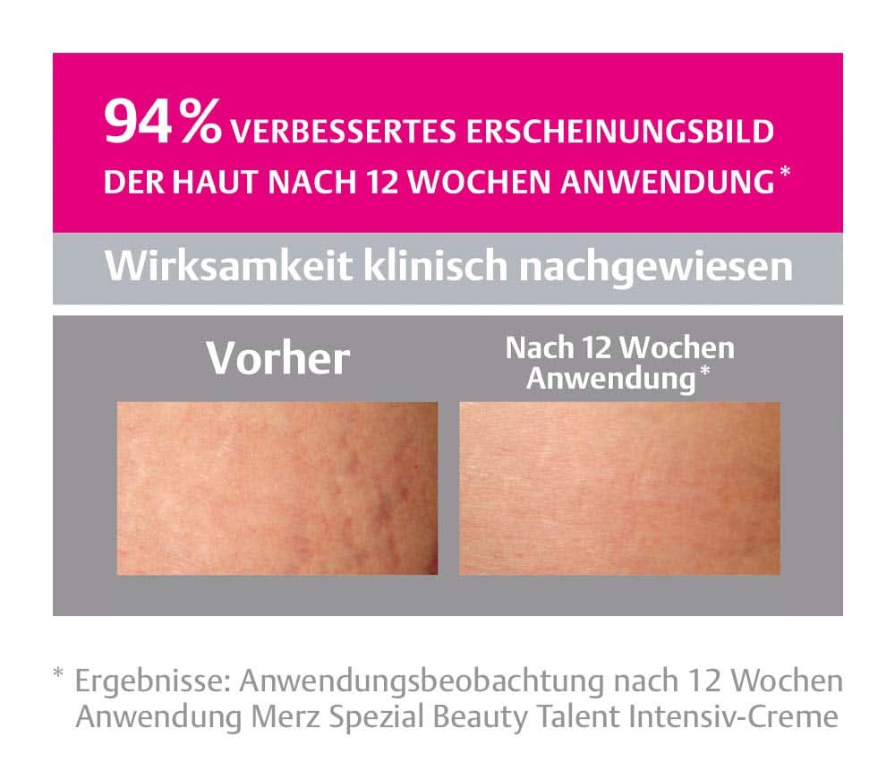 Merz Spezial, Intensiv kräm för hudbristningar, 75 ml Cosmetics and Beauty Naty Shop