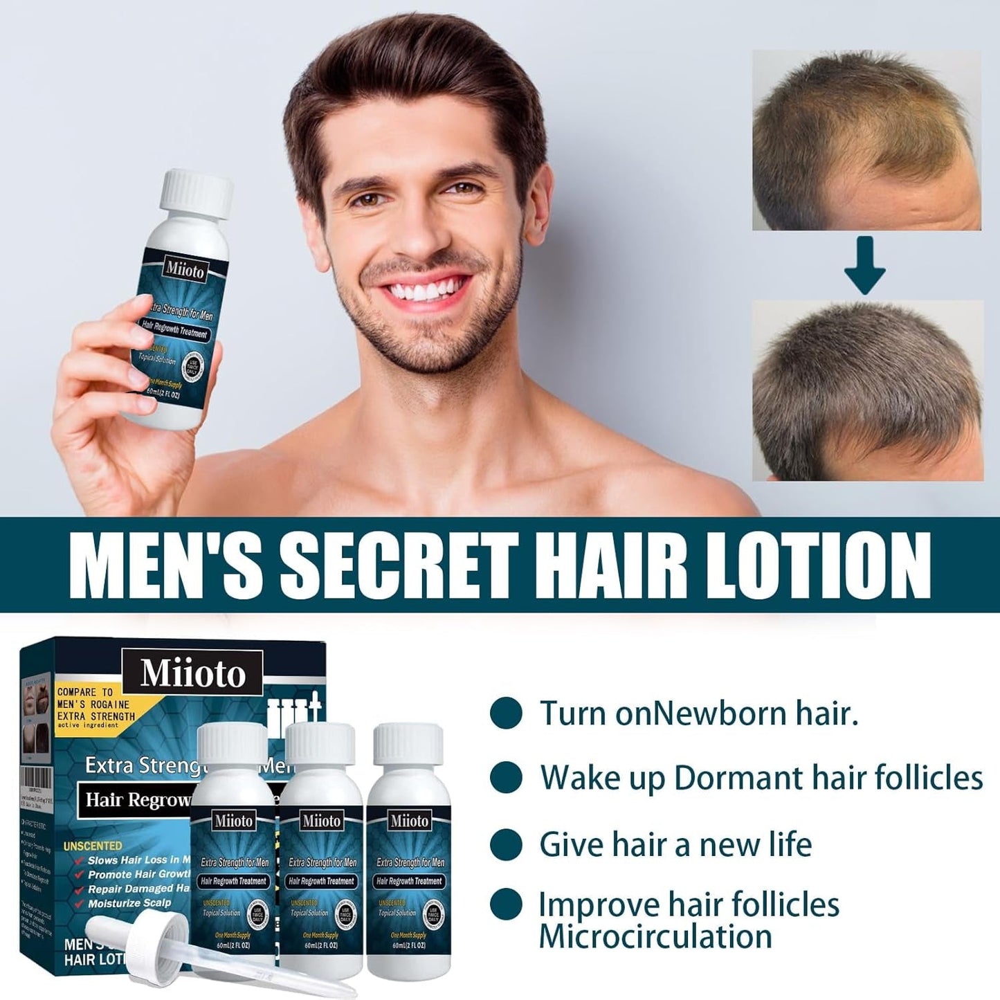 Miioto Hair Growth Serum Herr Hårväxt Produkt Hårväxt Hår Serum Hårbottenvård Främja tjockare hår Nära hårbotten Förhindra håravfall 3*60ML Hårvård Naty Shop
