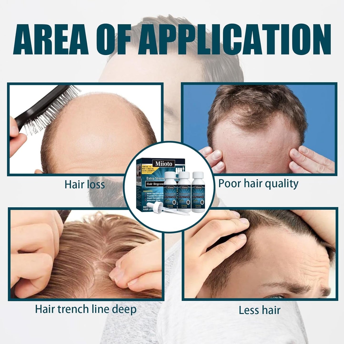 Miioto Hair Growth Serum Herr Hårväxt Produkt Hårväxt Hår Serum Hårbottenvård Främja tjockare hår Nära hårbotten Förhindra håravfall 3*60ML Hårvård Naty Shop