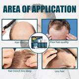 Miioto Hair Growth Serum Herr Hårväxt Produkt Hårväxt Hår Serum Hårbottenvård Främja tjockare hår Nära hårbotten Förhindra håravfall 3*60ML Hårvård Naty Shop