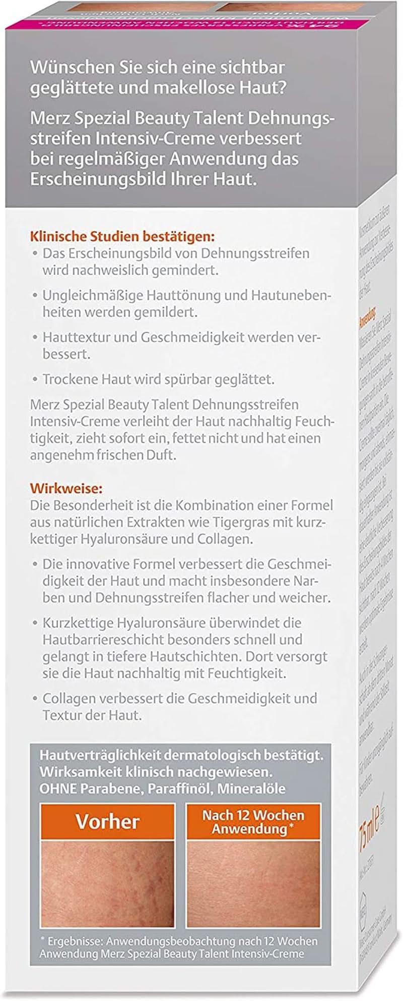 Merz Spezial, Intensiv kräm för hudbristningar, 75 ml Cosmetics and Beauty Naty Shop