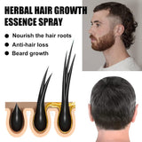 Advanced Hair Growth Treatment Kit 30ml 2ST Hair Growth Spray Hair Growth Roller och Essence Set Hair Growth Serum Anti Håravfall Advanced Hair Growth Serum Hårvård Naty Shop
