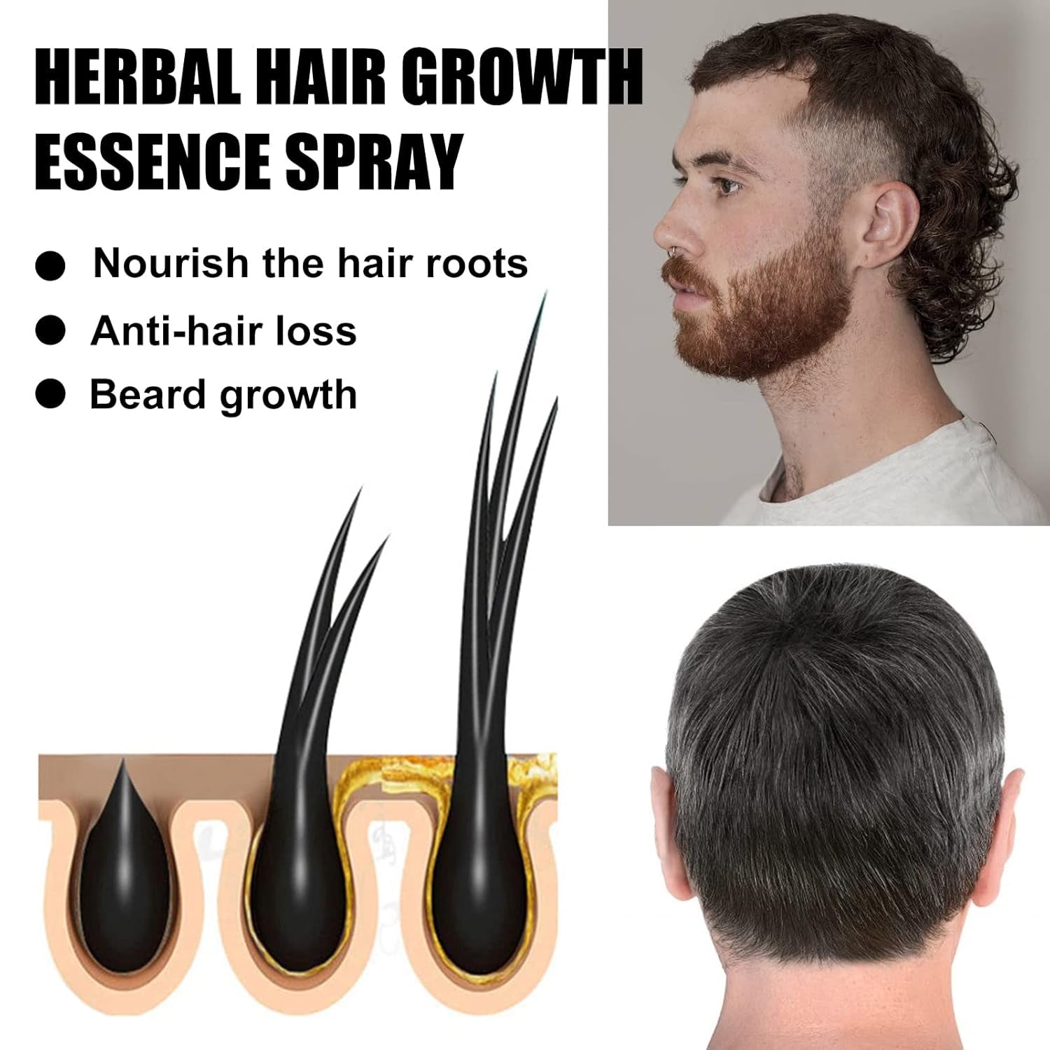 Advanced Hair Growth Treatment Kit 30ml 2ST Hair Growth Spray Hair Growth Roller och Essence Set Hair Growth Serum Anti Håravfall Advanced Hair Growth Serum Hårvård Naty Shop